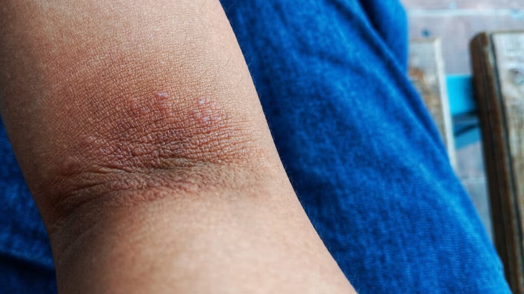 STAT+: A biotech hedge fund births a new immunology company