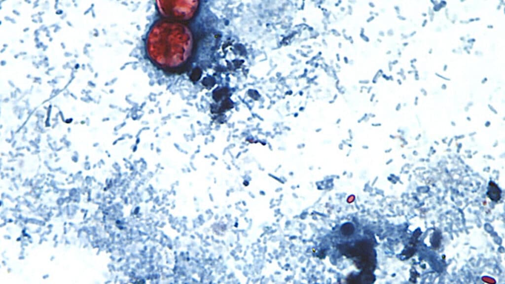 Michigan reports first two U.S. deaths in outbreak of cyclospora